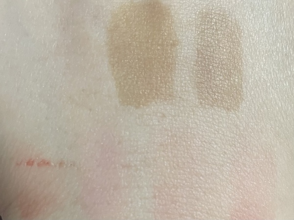 타투팩들 하루 지난 사진